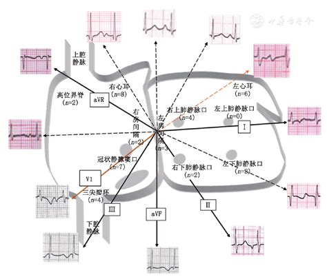 灶動的心結局|[閒聊] (雷) 灶動的心 最終回125 山部心胸咚咚！